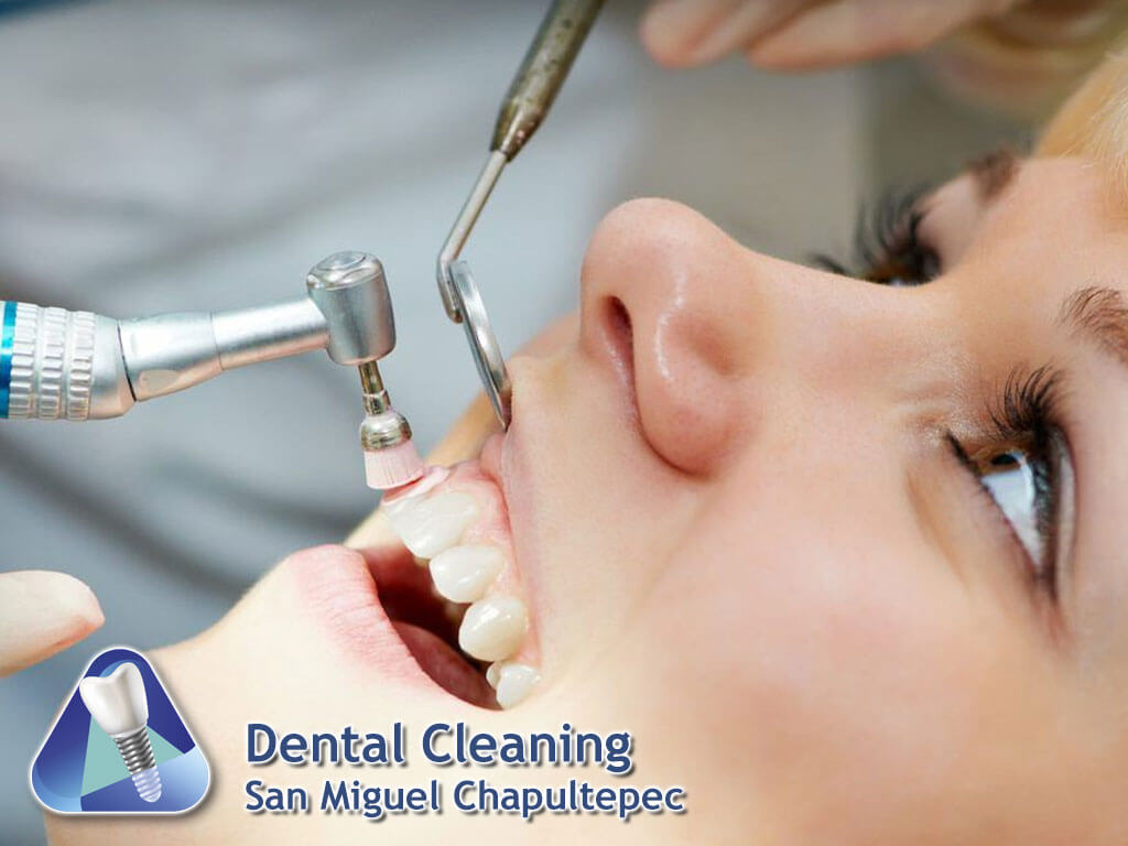 Dental Cleaning San Miguel Chapultepec